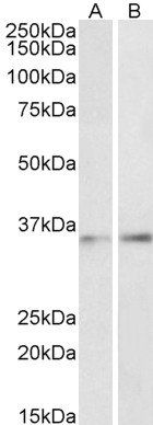 CEBPB (aa68-81) Antibody