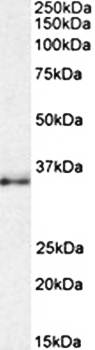 CEBPB (aa68-81) Antibody