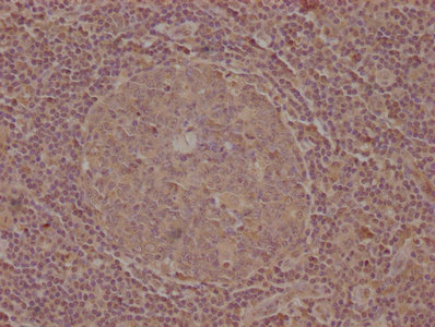 CELSR1 Antibody