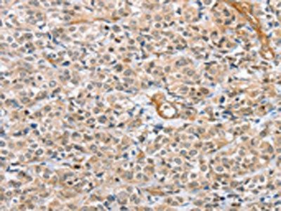 CENPC Antibody