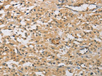 CENPF Antibody