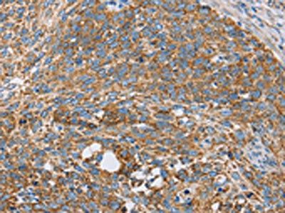 CENPO Antibody