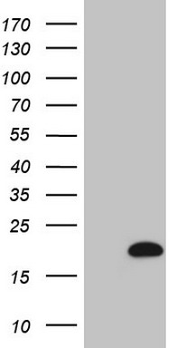 CETN3 Antibody
