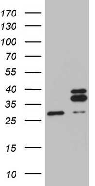 CETN3 Antibody