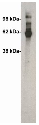 Rabbit Human Ceramide Kinase (rProtein-Full Length) Antibody