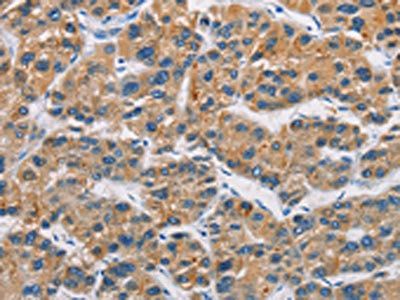 CERK Antibody