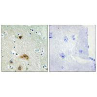 CERS4 Antibody