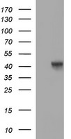 CCT8L2 Antibody