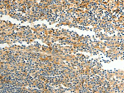 CFHR1 Antibody