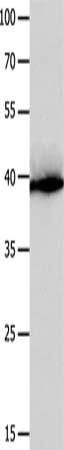 CFHR1 Antibody