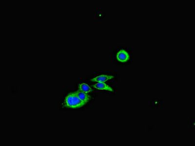CFL1 Antibody