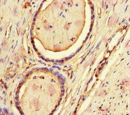CFL1 Antibody