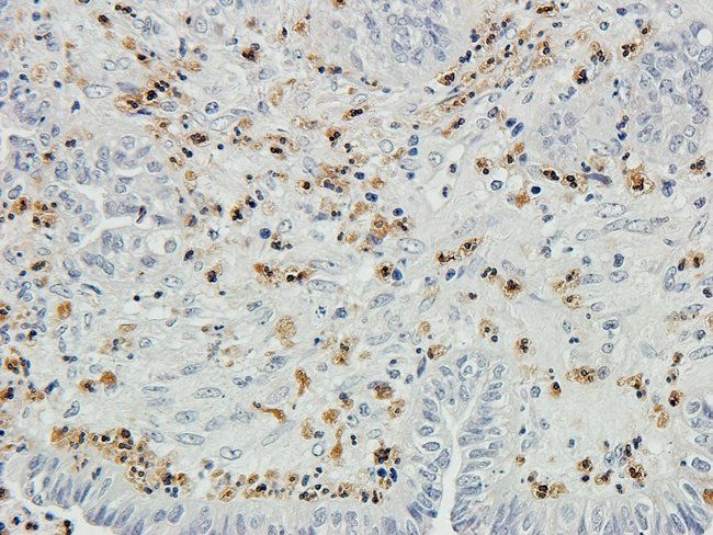 CHAT Rabbit Polyclonal Antibody