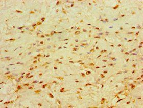 CHD1 Antibody