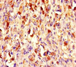 CHD4 Antibody