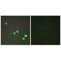 CHD4 Antibody