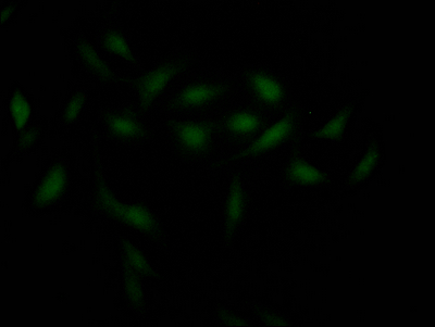 CHEK1 Antibody