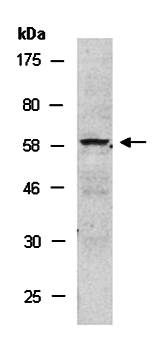CHEK1 (C) Antibody, Rabbit Polyclonal