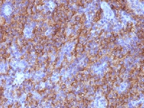 Chromogranin A / CHGA (Neuroendocrine Marker) Antibody
