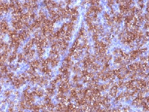 Chromogranin A / CHGA (Neuroendocrine Marker) Antibody