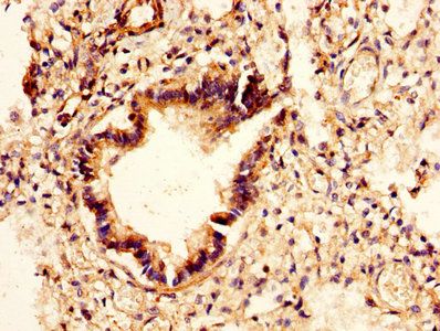 CHI3L2 Antibody