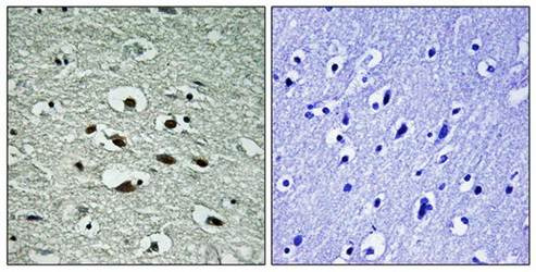 Chk1 (Phospho-Ser296) Antibody