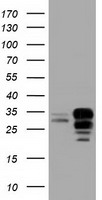 CHEK2 Antibody