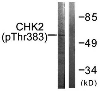 Chk2 (Phospho-Thr383) Antibody