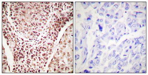 Chk2 (Phospho-Thr387) Antibody