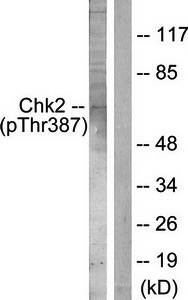 Chk2 (Phospho-Thr387) Antibody