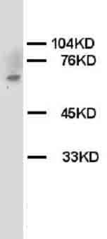 Chk2/CHEK2 Rabbit Polyclonal Antibody