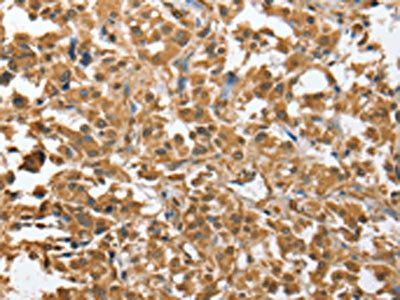CHMP4B Antibody