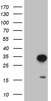 CHMP5 Antibody