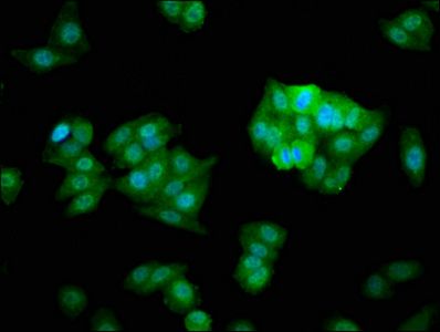 CHMP5 Antibody