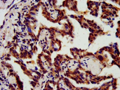 CHMP5 Antibody