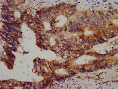 CHMP5 Antibody