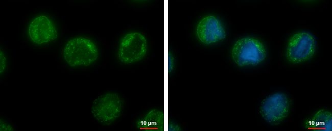 CHMP5 Rabbit Polyclonal Antibody