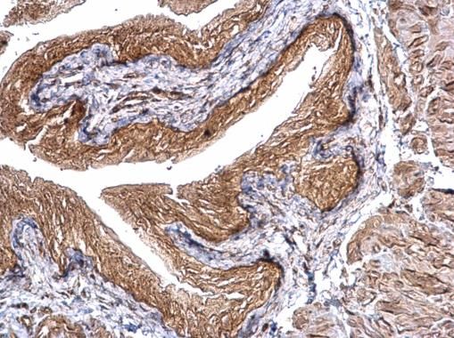 CHMP5 Rabbit Polyclonal Antibody