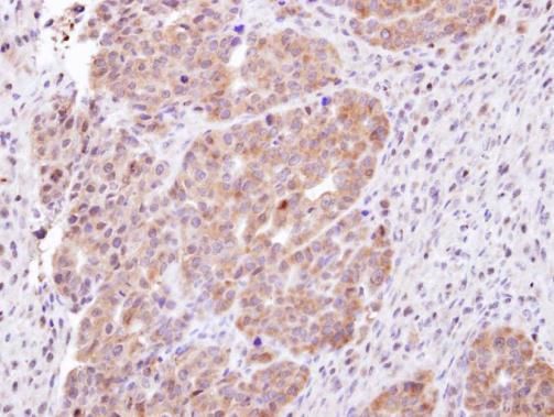 CHMP5 Rabbit Polyclonal Antibody