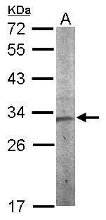 CHMP5 Rabbit Polyclonal Antibody