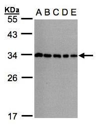 CHMP5 Rabbit Polyclonal Antibody
