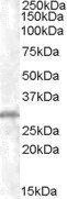 CHMP5 Antibody