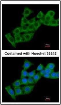 Calcium binding protein p22 Rabbit Polyclonal Antibody