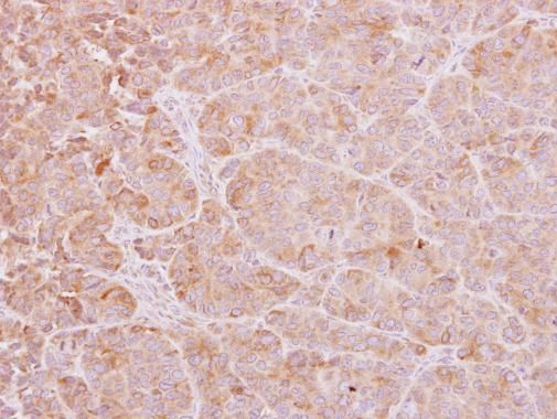 Calcium binding protein p22 Rabbit Polyclonal Antibody
