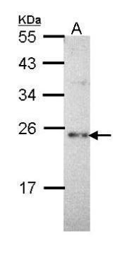 Calcium binding protein p22 Rabbit Polyclonal Antibody