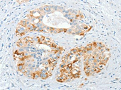 CHRDL2 Antibody
