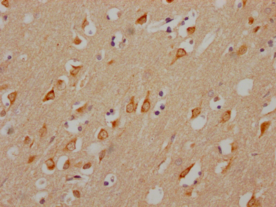 CHRM3 Antibody