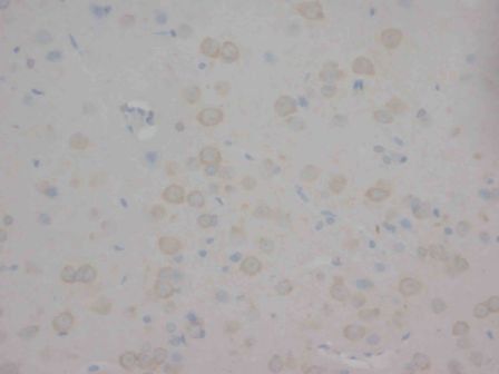 Nicotinic Acetylcholine Receptor alpha 1/CHRNA1 Rabbit Polyclonal Antibody