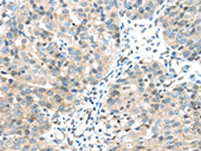 CHRNA1 Antibody