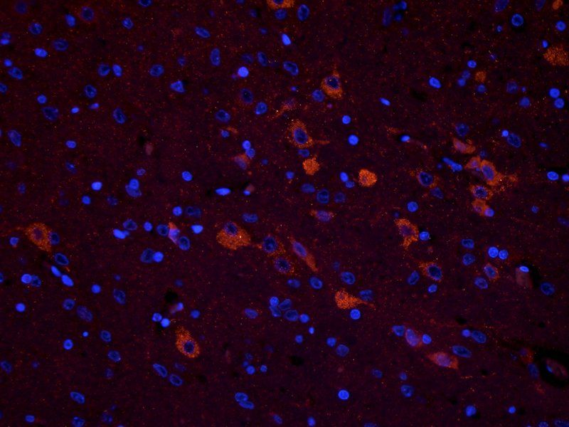 CHRNA7 Rabbit Polyclonal Antibody